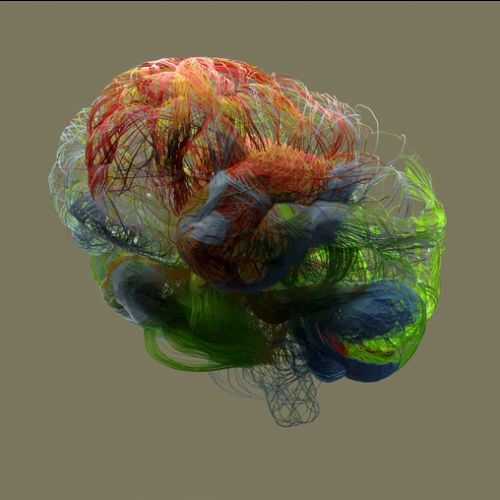 Image of the brain